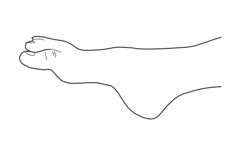 Plantar flexed big toe